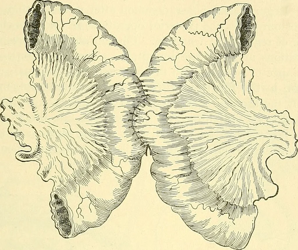 An illustration from Modern surgery, general and operative / by John Chalmers Da Costa., 1907, leaf 961