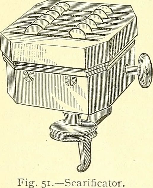 An illustration from Modern surgery, general and operative / by John Chalmers Da Costa., 1907, leaf 98