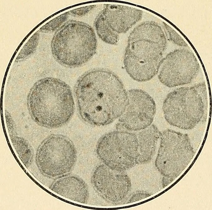 An illustration from The malarial fevers, haemoglobinuric fever and the blood protozoa of man / by Charles F. Craig ; illustrated by four colored plates, twenty-five clinical charts, and twenty-eight photomicrographs and drawings., 1909, leaf 40