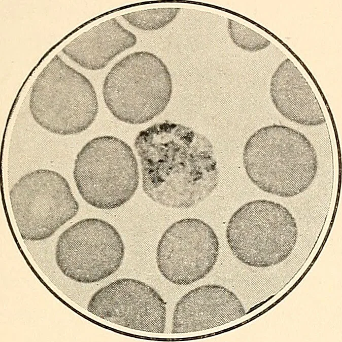 An illustration from The malarial fevers, haemoglobinuric fever and the blood protozoa of man / by Charles F. Craig ; illustrated by four colored plates, twenty-five clinical charts, and twenty-eight photomicrographs and drawings., 1909, leaf 45