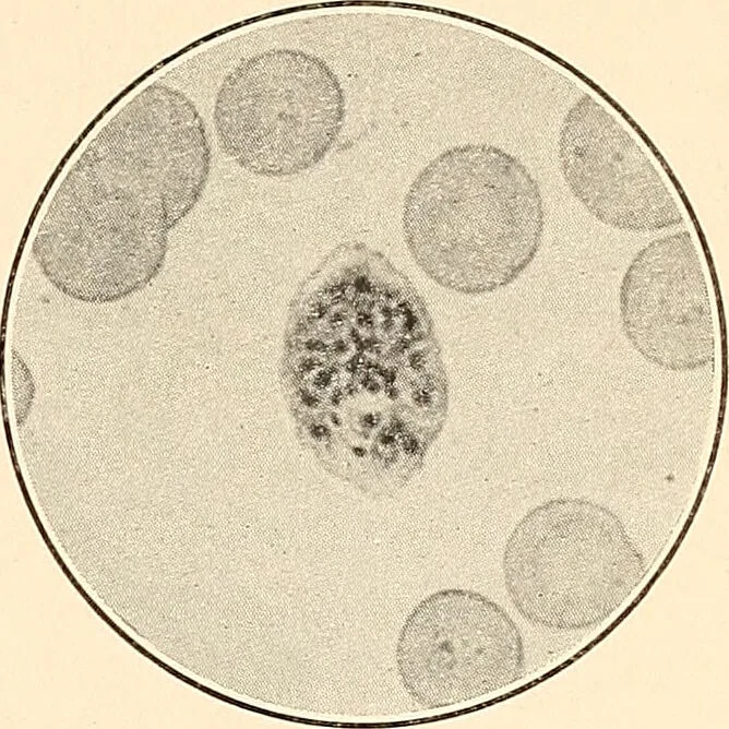 An illustration from The malarial fevers, haemoglobinuric fever and the blood protozoa of man / by Charles F. Craig ; illustrated by four colored plates, twenty-five clinical charts, and twenty-eight photomicrographs and drawings., 1909, leaf 45
