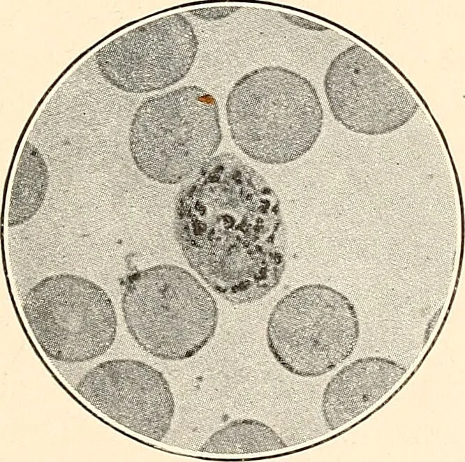 An illustration from The malarial fevers, haemoglobinuric fever and the blood protozoa of man / by Charles F. Craig ; illustrated by four colored plates, twenty-five clinical charts, and twenty-eight photomicrographs and drawings., 1909, leaf 45