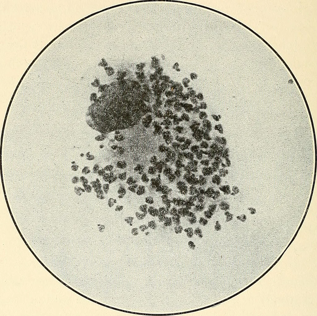 An illustration from The malarial fevers, haemoglobinuric fever and the blood protozoa of man / by Charles F. Craig ; illustrated by four colored plates, twenty-five clinical charts, and twenty-eight photomicrographs and drawings., 1909, leaf 458