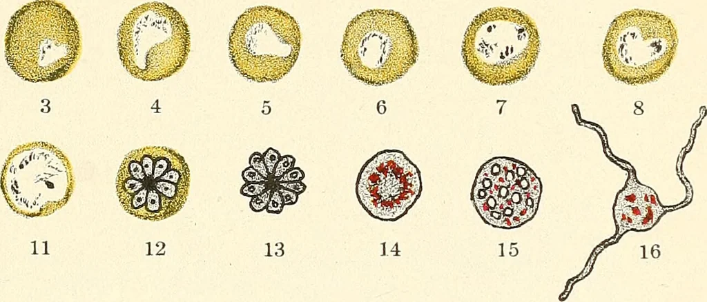 An illustration from The malarial fevers, haemoglobinuric fever and the blood protozoa of man / by Charles F. Craig ; illustrated by four colored plates, twenty-five clinical charts, and twenty-eight photomicrographs and drawings., 1909, leaf 49