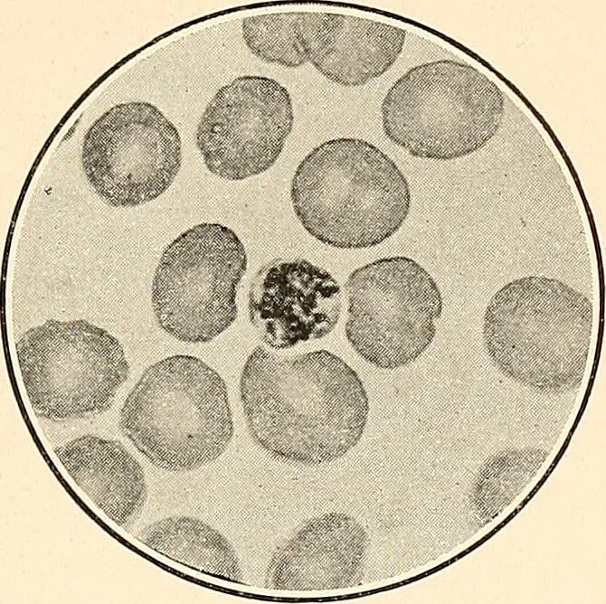 An illustration from The malarial fevers, haemoglobinuric fever and the blood protozoa of man / by Charles F. Craig ; illustrated by four colored plates, twenty-five clinical charts, and twenty-eight photomicrographs and drawings., 1909, leaf 53