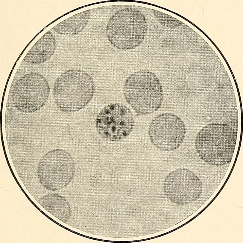 An illustration from The malarial fevers, haemoglobinuric fever and the blood protozoa of man / by Charles F. Craig ; illustrated by four colored plates, twenty-five clinical charts, and twenty-eight photomicrographs and drawings., 1909, leaf 53