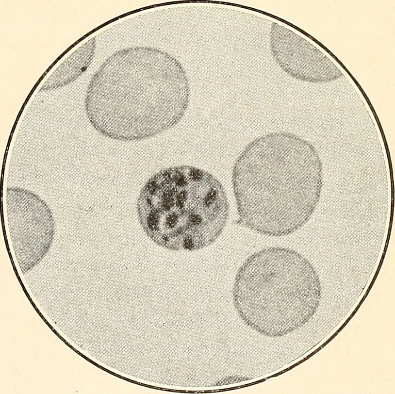 An illustration from The malarial fevers, haemoglobinuric fever and the blood protozoa of man / by Charles F. Craig ; illustrated by four colored plates, twenty-five clinical charts, and twenty-eight photomicrographs and drawings., 1909, leaf 53