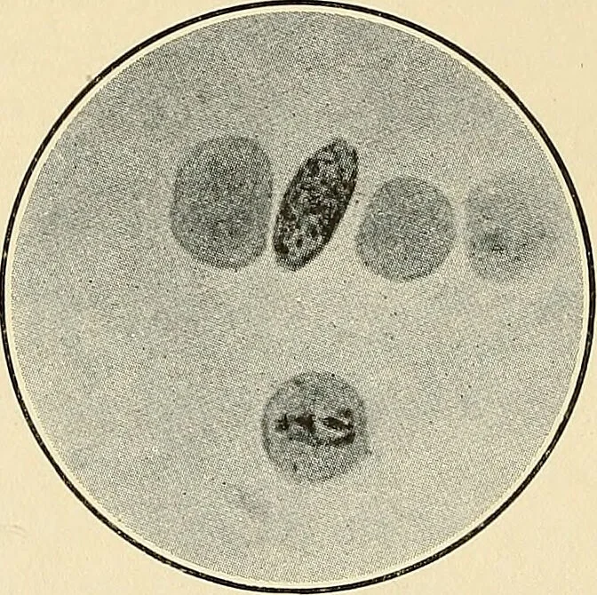 An illustration from The malarial fevers, haemoglobinuric fever and the blood protozoa of man / by Charles F. Craig ; illustrated by four colored plates, twenty-five clinical charts, and twenty-eight photomicrographs and drawings., 1909, leaf 82