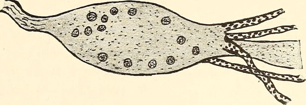 An illustration from The malarial fevers, haemoglobinuric fever and the blood protozoa of man / by Charles F. Craig ; illustrated by four colored plates, twenty-five clinical charts, and twenty-eight photomicrographs and drawings., 1909, leaf 93
