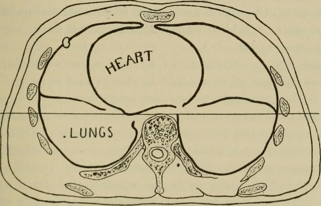 An illustration from The diagnostics of internal medicine : a clinical treatise upon the recognised principles of medical diagnosis, prepared for the use of students and practitioners of medicine / by Glentworth Reeve Butler ... ; with five coloured plates and two hundred and seventy-two illustrations and charts in the text., 1909, leaf 1035
