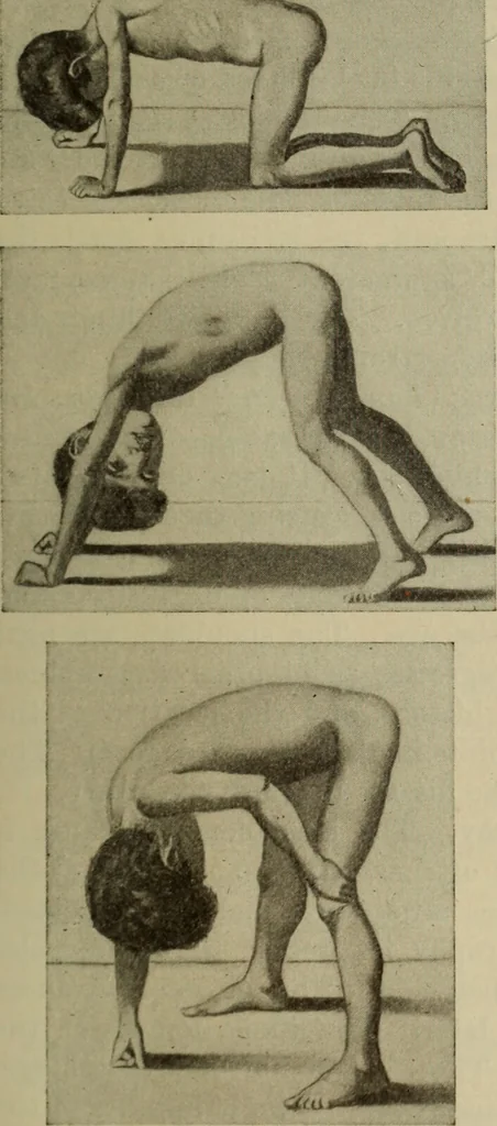 An illustration from The diagnostics of internal medicine : a clinical treatise upon the recognised principles of medical diagnosis, prepared for the use of students and practitioners of medicine / by Glentworth Reeve Butler ... ; with five coloured plates and two hundred and seventy-two illustrations and charts in the text., 1909, leaf 1107