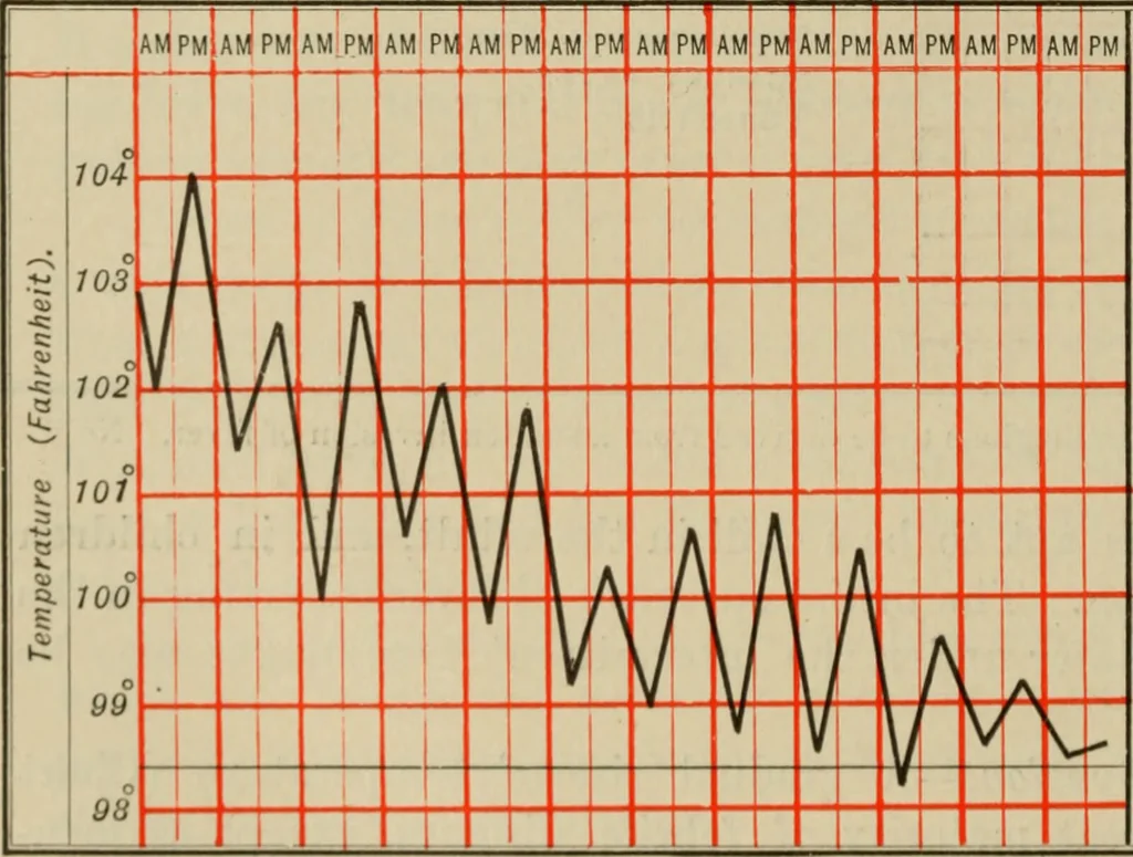 An illustration from The diagnostics of internal medicine : a clinical treatise upon the recognised principles of medical diagnosis, prepared for the use of students and practitioners of medicine / by Glentworth Reeve Butler ... ; with five coloured plates and two hundred and seventy-two illustrations and charts in the text., 1909, leaf 158