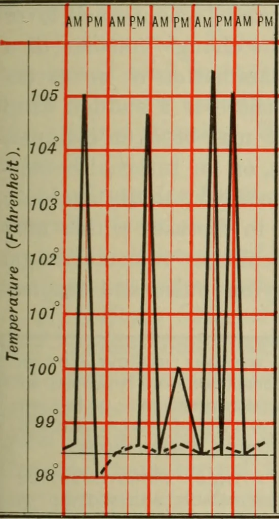 An illustration from The diagnostics of internal medicine : a clinical treatise upon the recognised principles of medical diagnosis, prepared for the use of students and practitioners of medicine / by Glentworth Reeve Butler ... ; with five coloured plates and two hundred and seventy-two illustrations and charts in the text., 1909, leaf 159