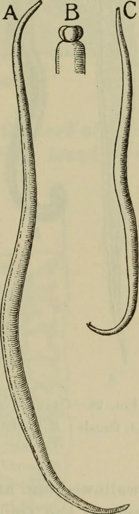An illustration from The diagnostics of internal medicine : a clinical treatise upon the recognised principles of medical diagnosis, prepared for the use of students and practitioners of medicine / by Glentworth Reeve Butler ... ; with five coloured plates and two hundred and seventy-two illustrations and charts in the text., 1909, leaf 191