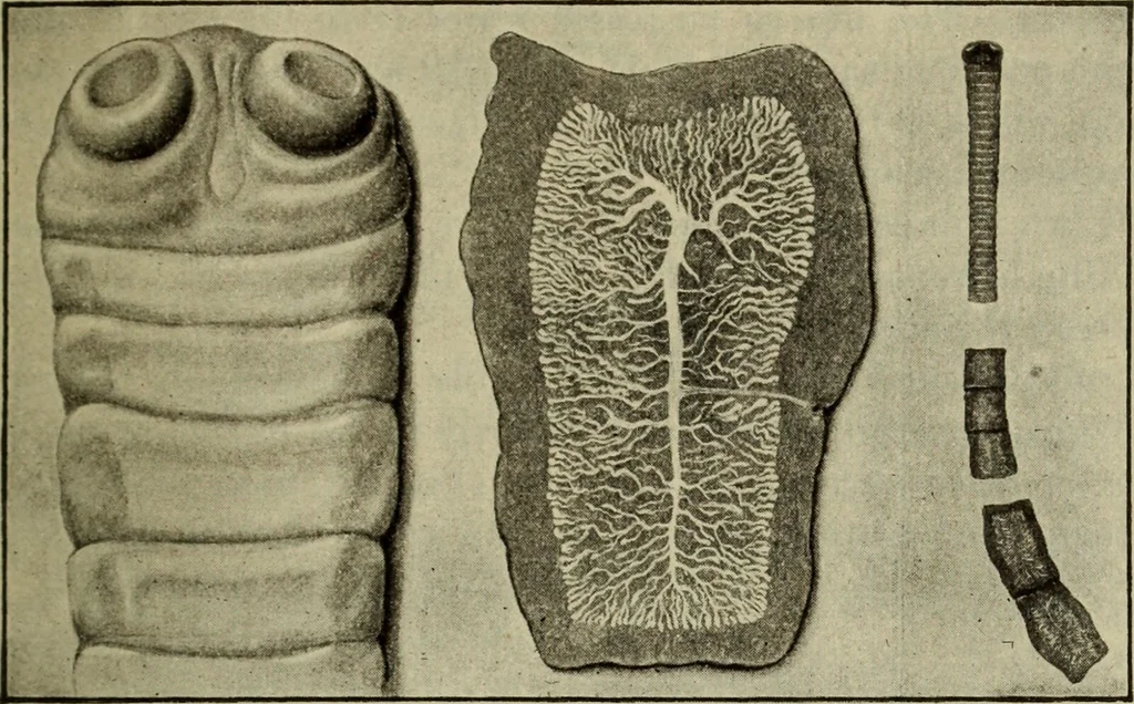 An illustration from The diagnostics of internal medicine : a clinical treatise upon the recognised principles of medical diagnosis, prepared for the use of students and practitioners of medicine / by Glentworth Reeve Butler ... ; with five coloured plates and two hundred and seventy-two illustrations and charts in the text., 1909, leaf 193