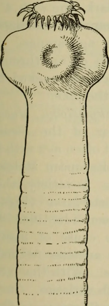 An illustration from The diagnostics of internal medicine : a clinical treatise upon the recognised principles of medical diagnosis, prepared for the use of students and practitioners of medicine / by Glentworth Reeve Butler ... ; with five coloured plates and two hundred and seventy-two illustrations and charts in the text., 1909, leaf 193