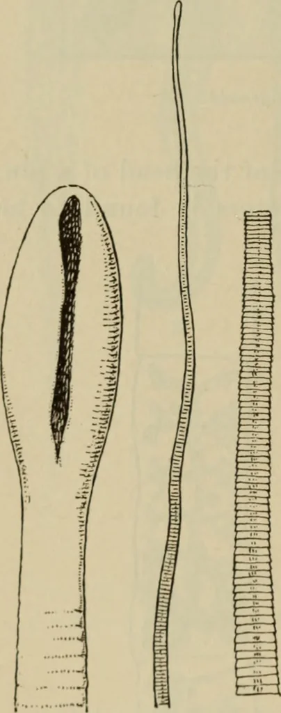 An illustration from The diagnostics of internal medicine : a clinical treatise upon the recognised principles of medical diagnosis, prepared for the use of students and practitioners of medicine / by Glentworth Reeve Butler ... ; with five coloured plates and two hundred and seventy-two illustrations and charts in the text., 1909, leaf 194