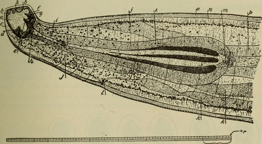 An illustration from The diagnostics of internal medicine : a clinical treatise upon the recognised principles of medical diagnosis, prepared for the use of students and practitioners of medicine / by Glentworth Reeve Butler ... ; with five coloured plates and two hundred and seventy-two illustrations and charts in the text., 1909, leaf 195