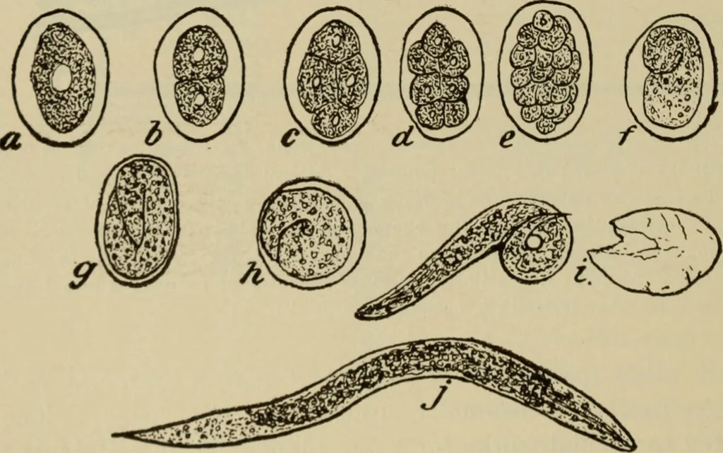An illustration from The diagnostics of internal medicine : a clinical treatise upon the recognised principles of medical diagnosis, prepared for the use of students and practitioners of medicine / by Glentworth Reeve Butler ... ; with five coloured plates and two hundred and seventy-two illustrations and charts in the text., 1909, leaf 196