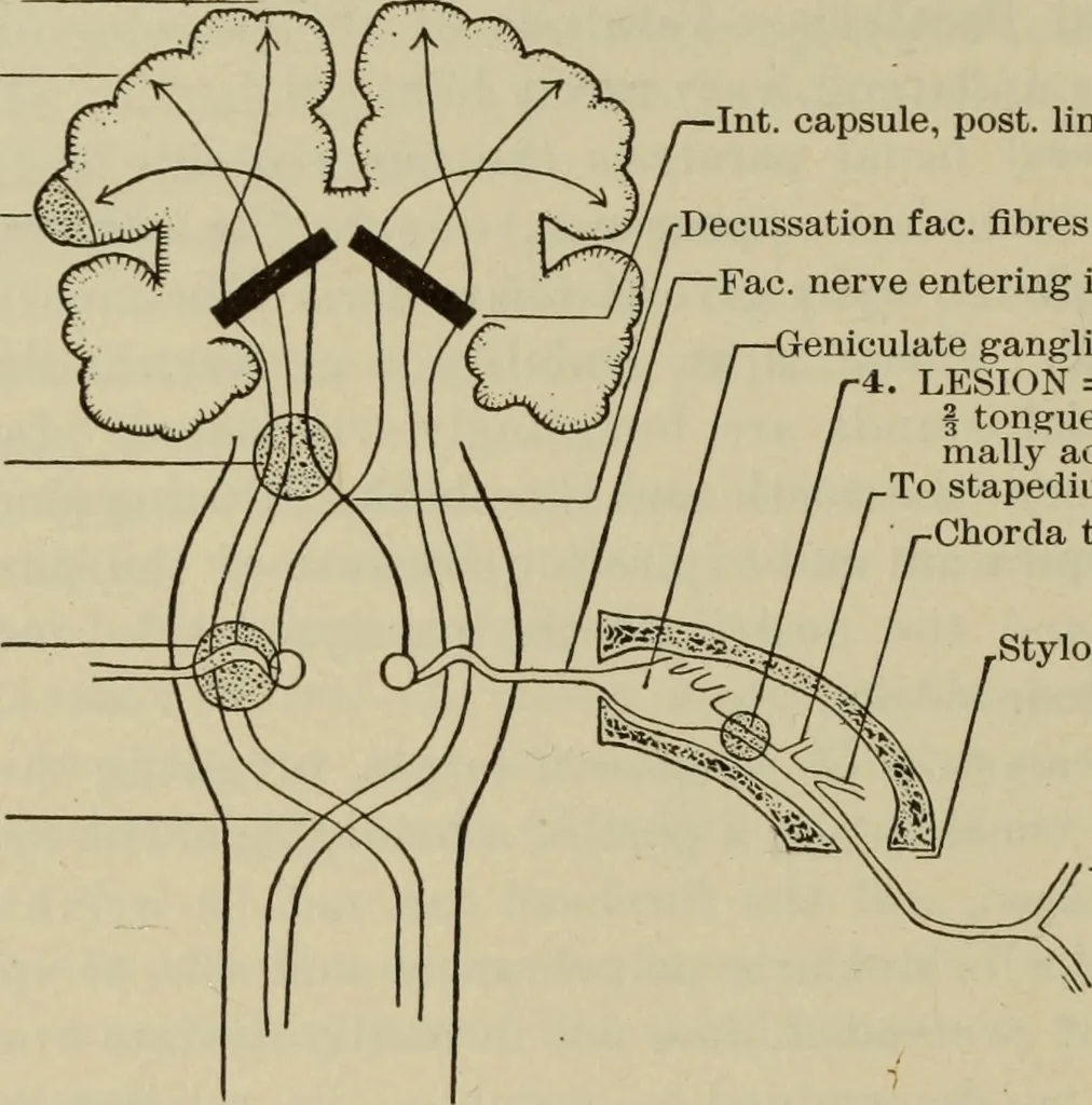 An illustration from The diagnostics of internal medicine : a clinical treatise upon the recognised principles of medical diagnosis, prepared for the use of students and practitioners of medicine / by Glentworth Reeve Butler ... ; with five coloured plates and two hundred and seventy-two illustrations and charts in the text., 1909, leaf 228