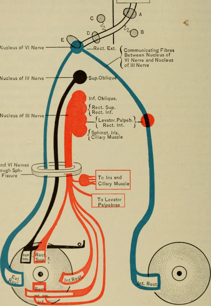 An illustration from The diagnostics of internal medicine : a clinical treatise upon the recognised principles of medical diagnosis, prepared for the use of students and practitioners of medicine / by Glentworth Reeve Butler ... ; with five coloured plates and two hundred and seventy-two illustrations and charts in the text., 1909, leaf 252