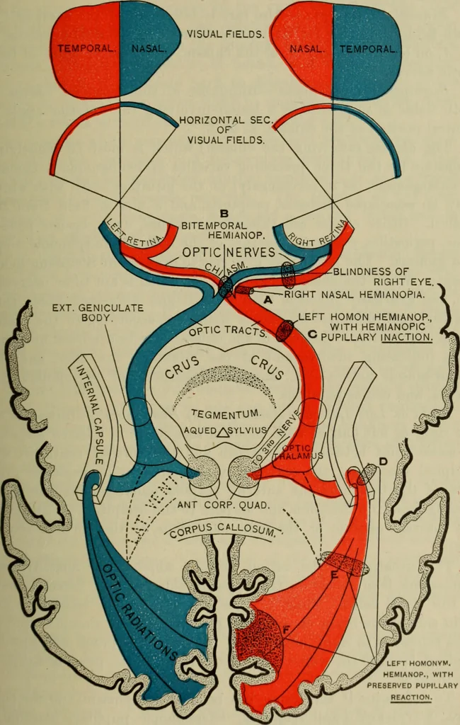 An illustration from The diagnostics of internal medicine : a clinical treatise upon the recognised principles of medical diagnosis, prepared for the use of students and practitioners of medicine / by Glentworth Reeve Butler ... ; with five coloured plates and two hundred and seventy-two illustrations and charts in the text., 1909, leaf 261