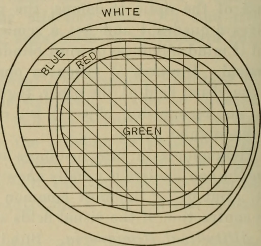 An illustration from The diagnostics of internal medicine : a clinical treatise upon the recognised principles of medical diagnosis, prepared for the use of students and practitioners of medicine / by Glentworth Reeve Butler ... ; with five coloured plates and two hundred and seventy-two illustrations and charts in the text., 1909, leaf 266