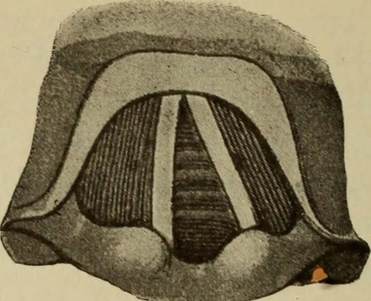 An illustration from The diagnostics of internal medicine : a clinical treatise upon the recognised principles of medical diagnosis, prepared for the use of students and practitioners of medicine / by Glentworth Reeve Butler ... ; with five coloured plates and two hundred and seventy-two illustrations and charts in the text., 1909, leaf 300
