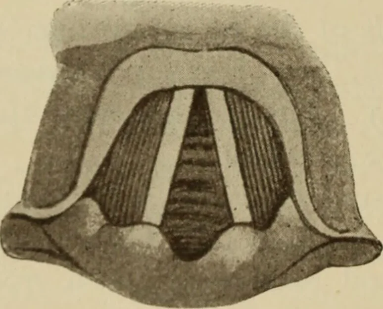 An illustration from The diagnostics of internal medicine : a clinical treatise upon the recognised principles of medical diagnosis, prepared for the use of students and practitioners of medicine / by Glentworth Reeve Butler ... ; with five coloured plates and two hundred and seventy-two illustrations and charts in the text., 1909, leaf 300