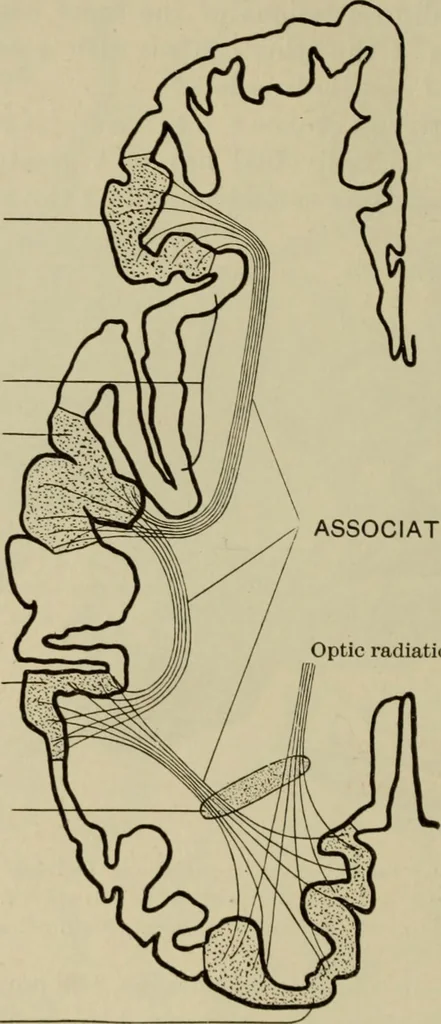 An illustration from The diagnostics of internal medicine : a clinical treatise upon the recognised principles of medical diagnosis, prepared for the use of students and practitioners of medicine / by Glentworth Reeve Butler ... ; with five coloured plates and two hundred and seventy-two illustrations and charts in the text., 1909, leaf 310