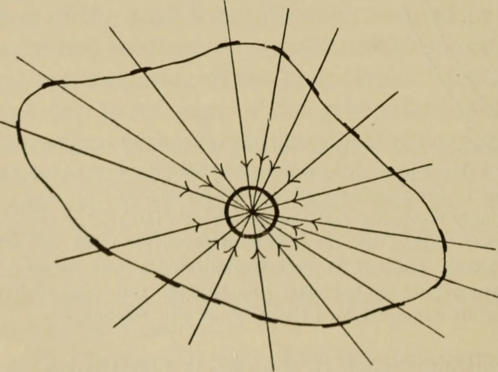An illustration from The diagnostics of internal medicine : a clinical treatise upon the recognised principles of medical diagnosis, prepared for the use of students and practitioners of medicine / by Glentworth Reeve Butler ... ; with five coloured plates and two hundred and seventy-two illustrations and charts in the text., 1909, leaf 352