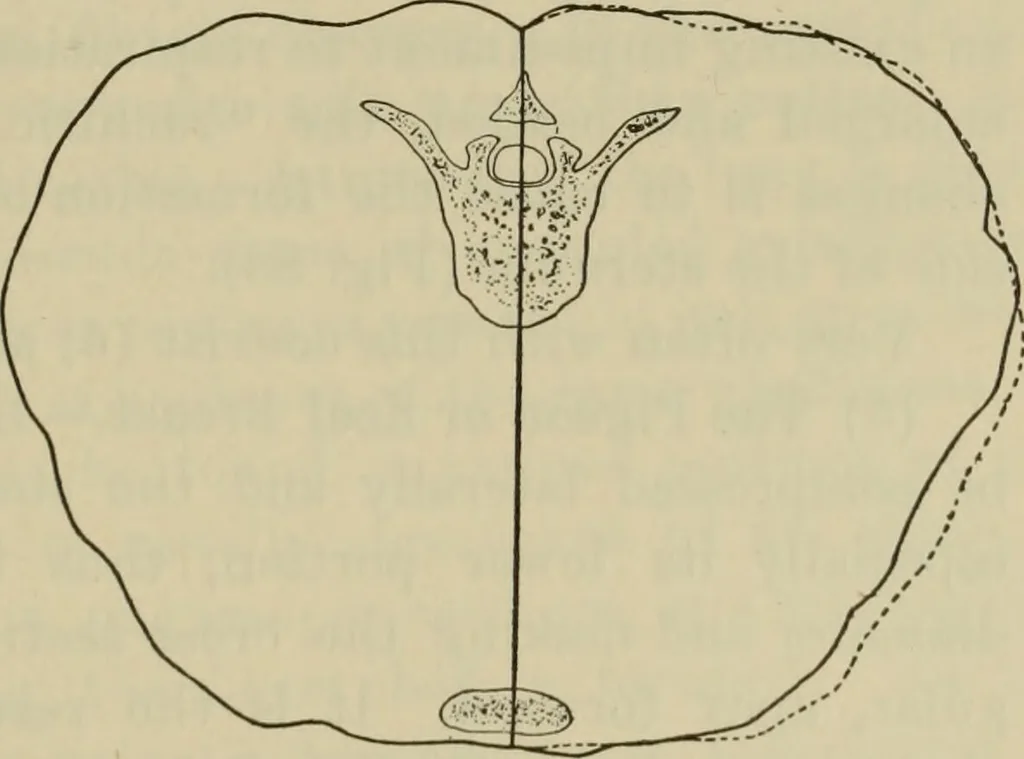 An illustration from The diagnostics of internal medicine : a clinical treatise upon the recognised principles of medical diagnosis, prepared for the use of students and practitioners of medicine / by Glentworth Reeve Butler ... ; with five coloured plates and two hundred and seventy-two illustrations and charts in the text., 1909, leaf 359