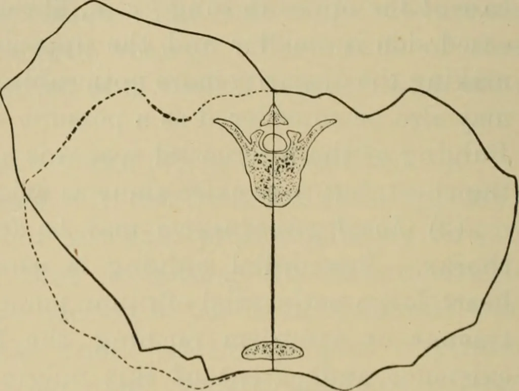 An illustration from The diagnostics of internal medicine : a clinical treatise upon the recognised principles of medical diagnosis, prepared for the use of students and practitioners of medicine / by Glentworth Reeve Butler ... ; with five coloured plates and two hundred and seventy-two illustrations and charts in the text., 1909, leaf 362