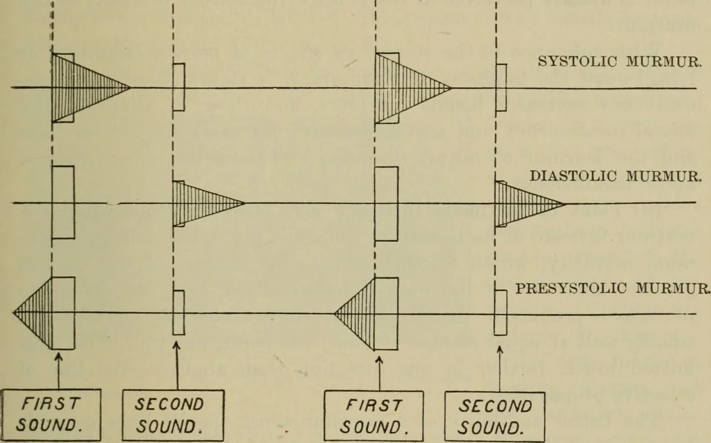 An illustration from The diagnostics of internal medicine : a clinical treatise upon the recognised principles of medical diagnosis, prepared for the use of students and practitioners of medicine / by Glentworth Reeve Butler ... ; with five coloured plates and two hundred and seventy-two illustrations and charts in the text., 1909, leaf 411