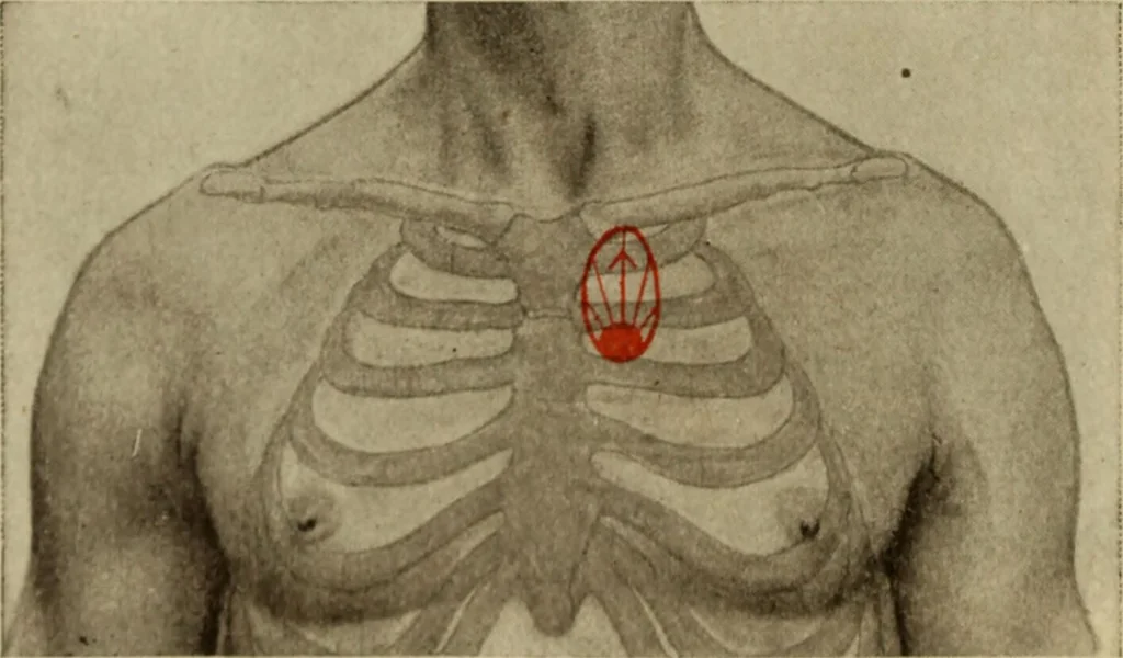 An illustration from The diagnostics of internal medicine : a clinical treatise upon the recognised principles of medical diagnosis, prepared for the use of students and practitioners of medicine / by Glentworth Reeve Butler ... ; with five coloured plates and two hundred and seventy-two illustrations and charts in the text., 1909, leaf 420