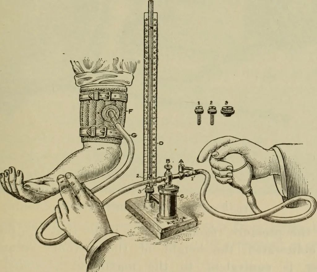 An illustration from The diagnostics of internal medicine : a clinical treatise upon the recognised principles of medical diagnosis, prepared for the use of students and practitioners of medicine / by Glentworth Reeve Butler ... ; with five coloured plates and two hundred and seventy-two illustrations and charts in the text., 1909, leaf 431
