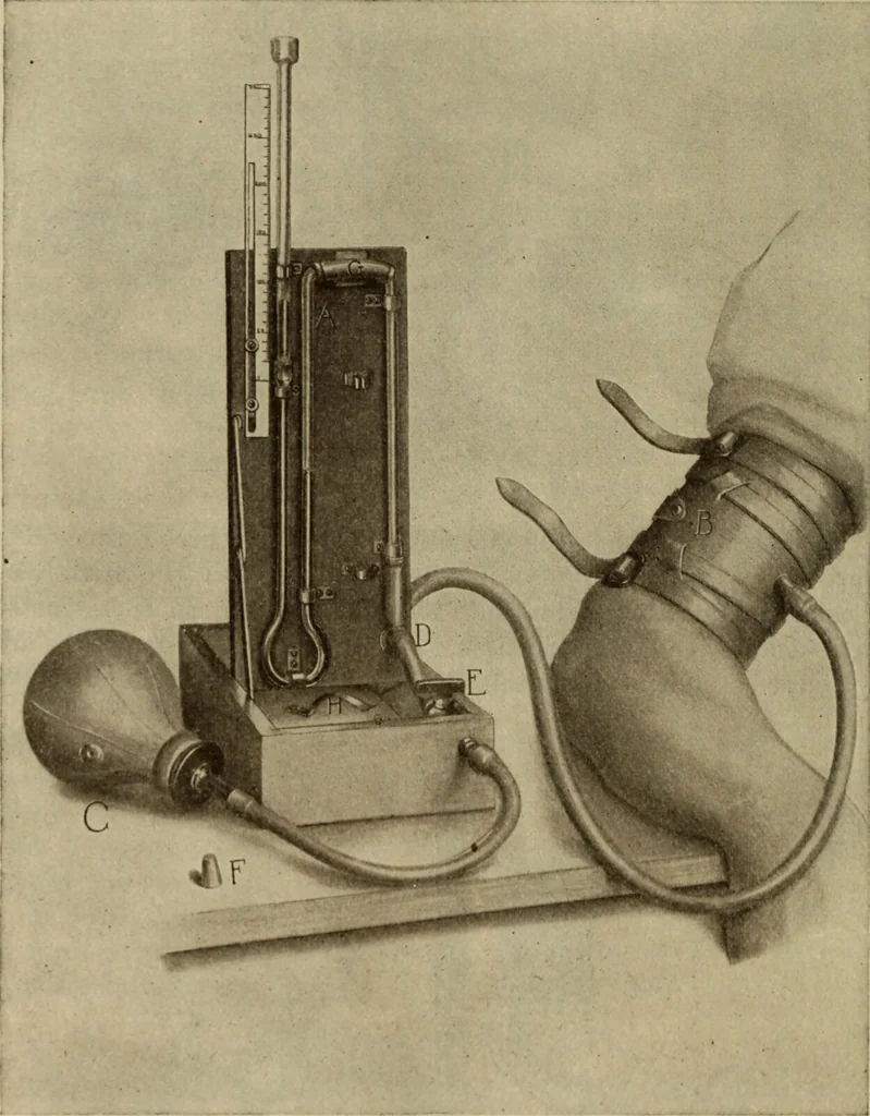 An illustration from The diagnostics of internal medicine : a clinical treatise upon the recognised principles of medical diagnosis, prepared for the use of students and practitioners of medicine / by Glentworth Reeve Butler ... ; with five coloured plates and two hundred and seventy-two illustrations and charts in the text., 1909, leaf 432