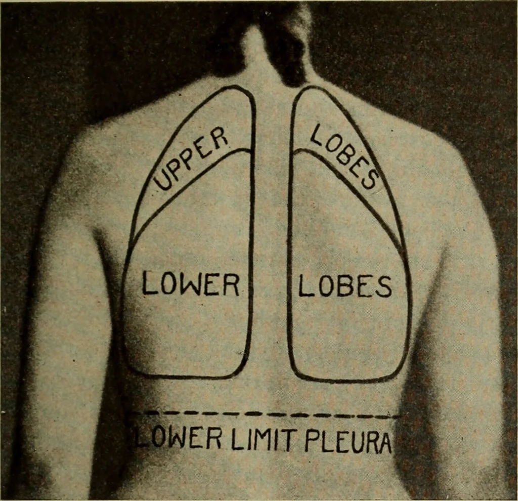 An illustration from The diagnostics of internal medicine : a clinical treatise upon the recognised principles of medical diagnosis, prepared for the use of students and practitioners of medicine / by Glentworth Reeve Butler ... ; with five coloured plates and two hundred and seventy-two illustrations and charts in the text., 1909, leaf 455