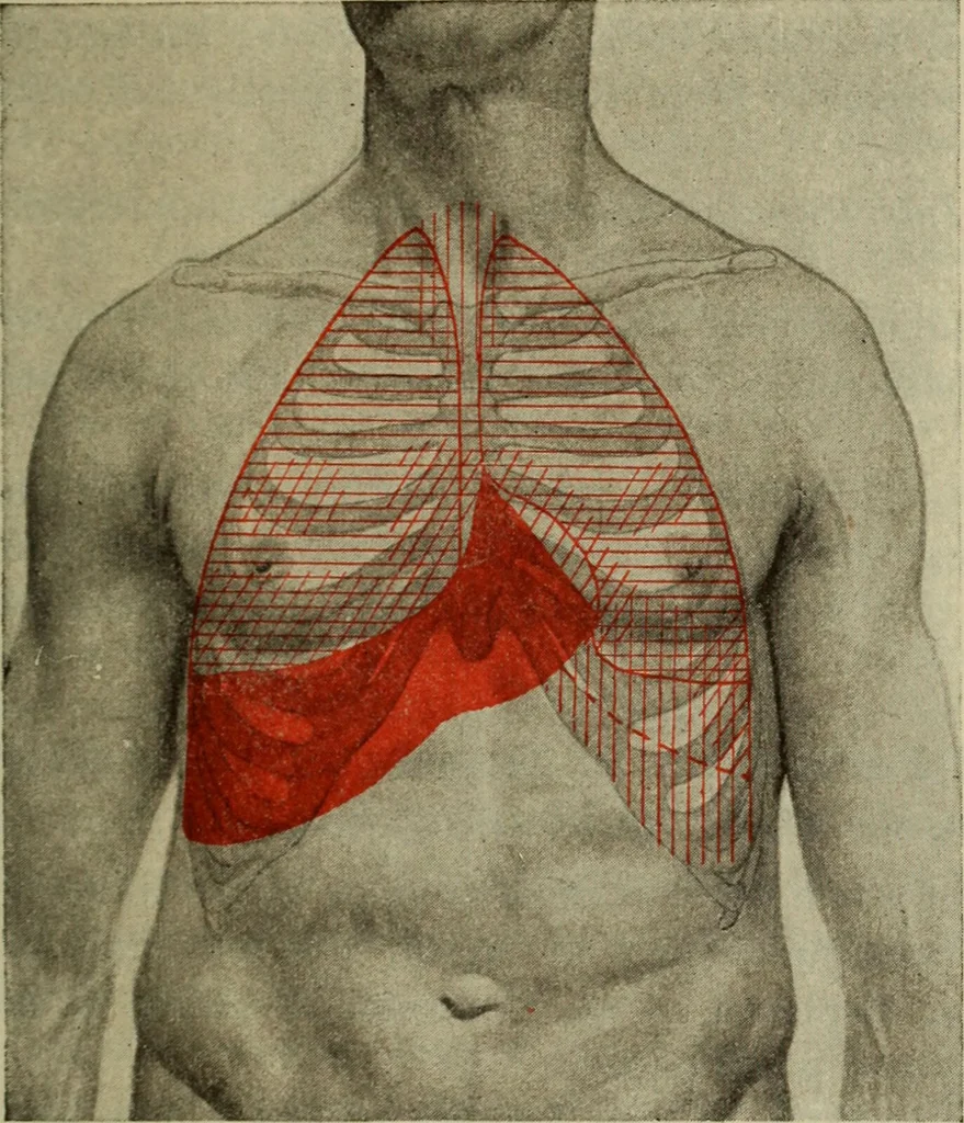 An illustration from The diagnostics of internal medicine : a clinical treatise upon the recognised principles of medical diagnosis, prepared for the use of students and practitioners of medicine / by Glentworth Reeve Butler ... ; with five coloured plates and two hundred and seventy-two illustrations and charts in the text., 1909, leaf 471