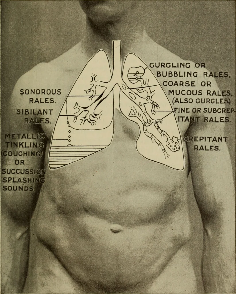 An illustration from The diagnostics of internal medicine : a clinical treatise upon the recognised principles of medical diagnosis, prepared for the use of students and practitioners of medicine / by Glentworth Reeve Butler ... ; with five coloured plates and two hundred and seventy-two illustrations and charts in the text., 1909, leaf 493