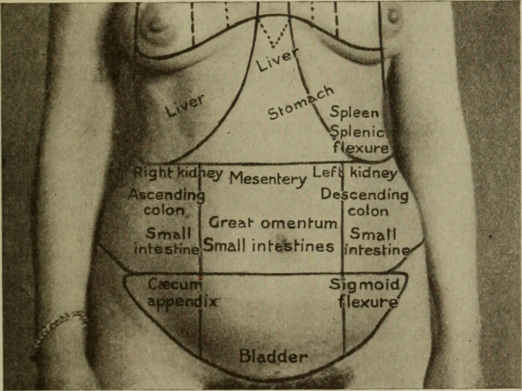 An illustration from The diagnostics of internal medicine : a clinical treatise upon the recognised principles of medical diagnosis, prepared for the use of students and practitioners of medicine / by Glentworth Reeve Butler ... ; with five coloured plates and two hundred and seventy-two illustrations and charts in the text., 1909, leaf 501