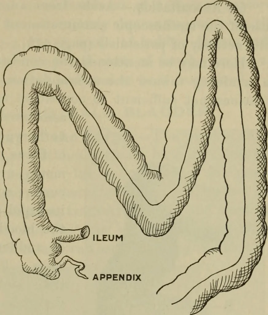 An illustration from The diagnostics of internal medicine : a clinical treatise upon the recognised principles of medical diagnosis, prepared for the use of students and practitioners of medicine / by Glentworth Reeve Butler ... ; with five coloured plates and two hundred and seventy-two illustrations and charts in the text., 1909, leaf 537