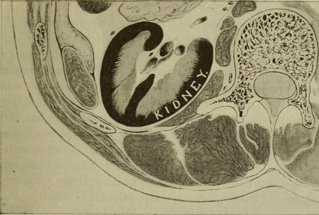 An illustration from The diagnostics of internal medicine : a clinical treatise upon the recognised principles of medical diagnosis, prepared for the use of students and practitioners of medicine / by Glentworth Reeve Butler ... ; with five coloured plates and two hundred and seventy-two illustrations and charts in the text., 1909, leaf 557