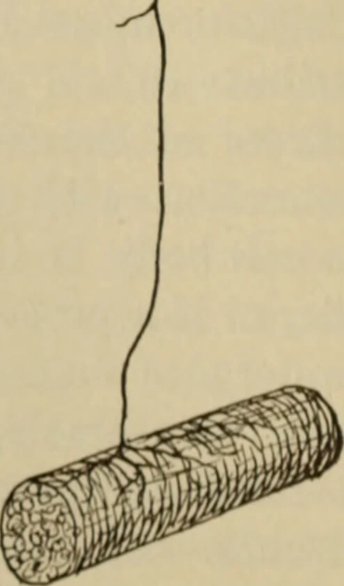 An illustration from The diagnostics of internal medicine : a clinical treatise upon the recognised principles of medical diagnosis, prepared for the use of students and practitioners of medicine / by Glentworth Reeve Butler ... ; with five coloured plates and two hundred and seventy-two illustrations and charts in the text., 1909, leaf 560