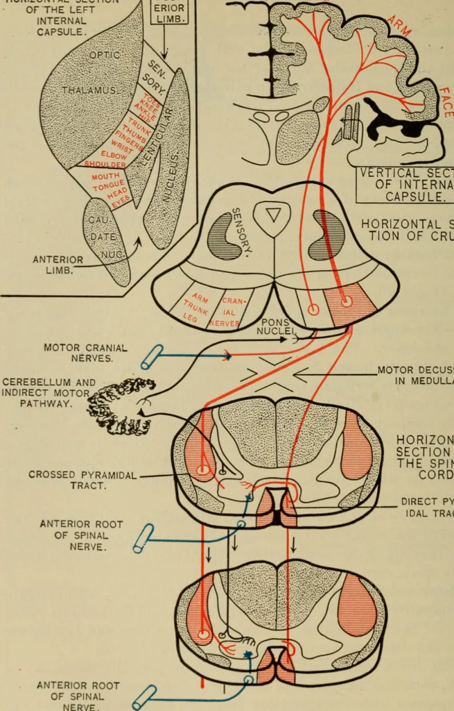 An illustration from The diagnostics of internal medicine : a clinical treatise upon the recognised principles of medical diagnosis, prepared for the use of students and practitioners of medicine / by Glentworth Reeve Butler ... ; with five coloured plates and two hundred and seventy-two illustrations and charts in the text., 1909, leaf 562