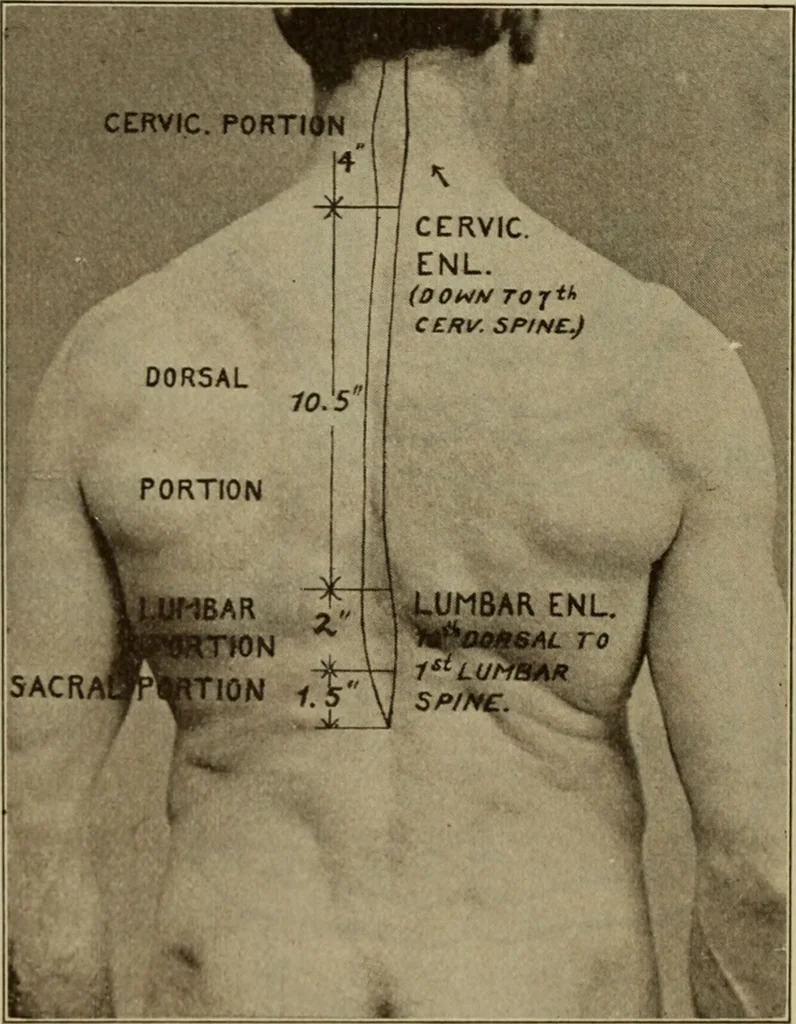 An illustration from The diagnostics of internal medicine : a clinical treatise upon the recognised principles of medical diagnosis, prepared for the use of students and practitioners of medicine / by Glentworth Reeve Butler ... ; with five coloured plates and two hundred and seventy-two illustrations and charts in the text., 1909, leaf 564