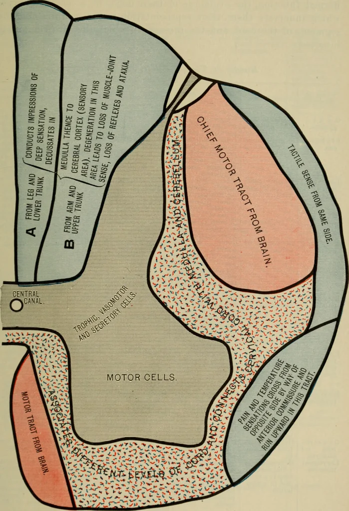 An illustration from The diagnostics of internal medicine : a clinical treatise upon the recognised principles of medical diagnosis, prepared for the use of students and practitioners of medicine / by Glentworth Reeve Butler ... ; with five coloured plates and two hundred and seventy-two illustrations and charts in the text., 1909, leaf 567