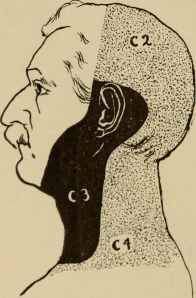 An illustration from The diagnostics of internal medicine : a clinical treatise upon the recognised principles of medical diagnosis, prepared for the use of students and practitioners of medicine / by Glentworth Reeve Butler ... ; with five coloured plates and two hundred and seventy-two illustrations and charts in the text., 1909, leaf 576