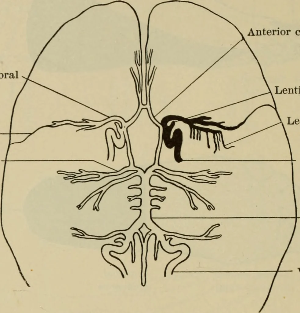 An illustration from The diagnostics of internal medicine : a clinical treatise upon the recognised principles of medical diagnosis, prepared for the use of students and practitioners of medicine / by Glentworth Reeve Butler ... ; with five coloured plates and two hundred and seventy-two illustrations and charts in the text., 1909, leaf 582