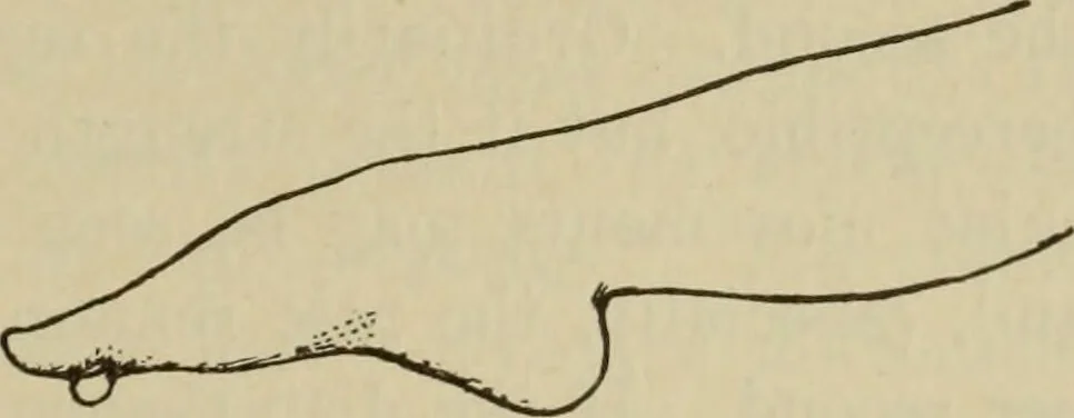 An illustration from The diagnostics of internal medicine : a clinical treatise upon the recognised principles of medical diagnosis, prepared for the use of students and practitioners of medicine / by Glentworth Reeve Butler ... ; with five coloured plates and two hundred and seventy-two illustrations and charts in the text., 1909, leaf 589